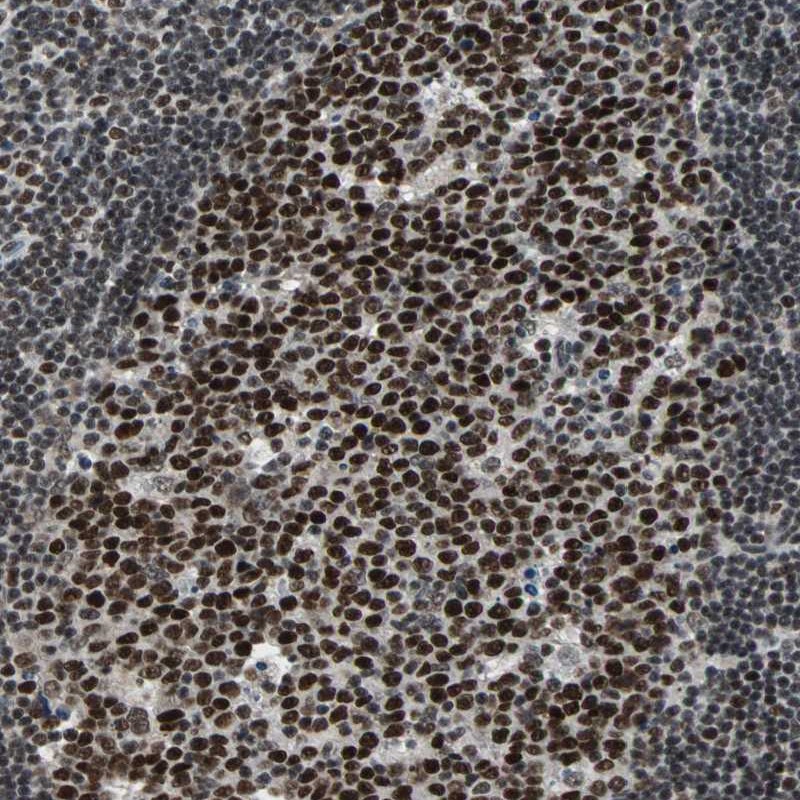 Atlas Antibodies Anti-TERF2IP Antibody
