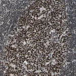Atlas Antibodies Anti-TERF2IP Antibody
