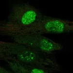 Atlas Antibodies Anti-TERT Antibody