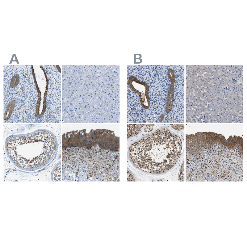 Atlas Antibodies Anti-TES Antibody