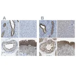 Atlas Antibodies Anti-TES Antibody