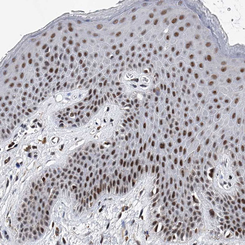 Atlas Antibodies Anti-TESK2 Antibody