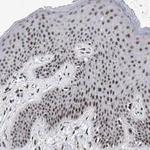 Atlas Antibodies Anti-TESK2 Antibody