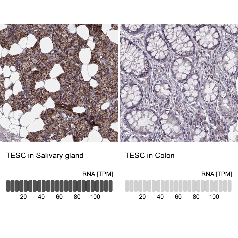 Atlas Antibodies Anti-TESC Antibody