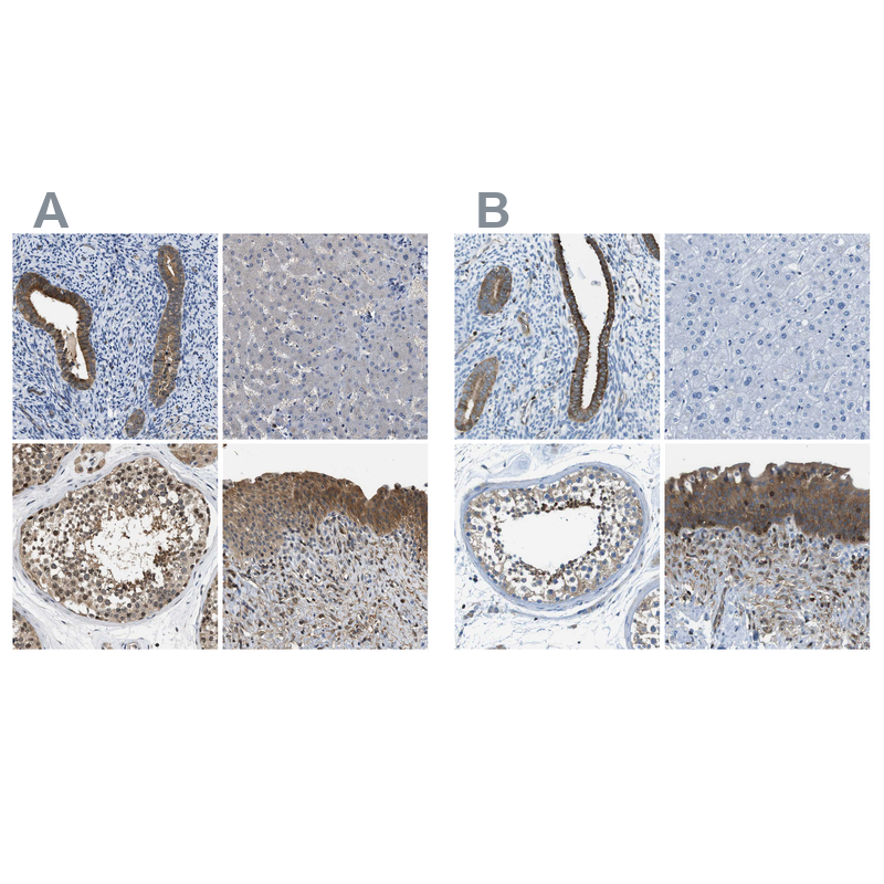 Atlas Antibodies Anti-TES Antibody