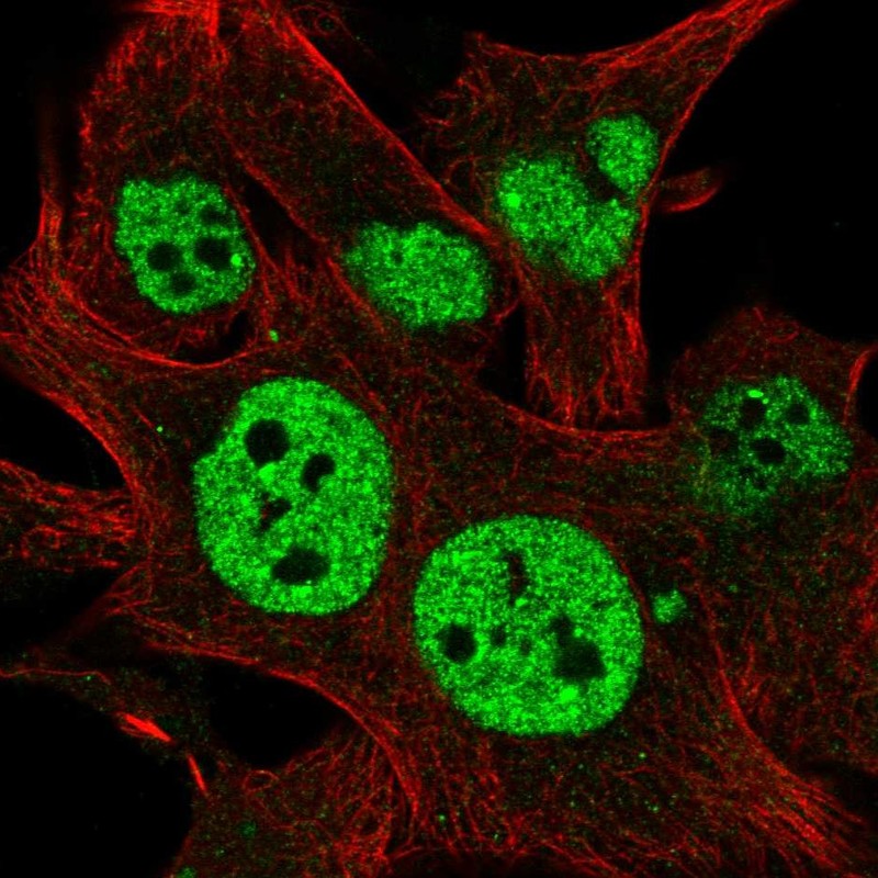 Atlas Antibodies Anti-TESK2 Antibody