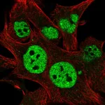 Atlas Antibodies Anti-TESK2 Antibody