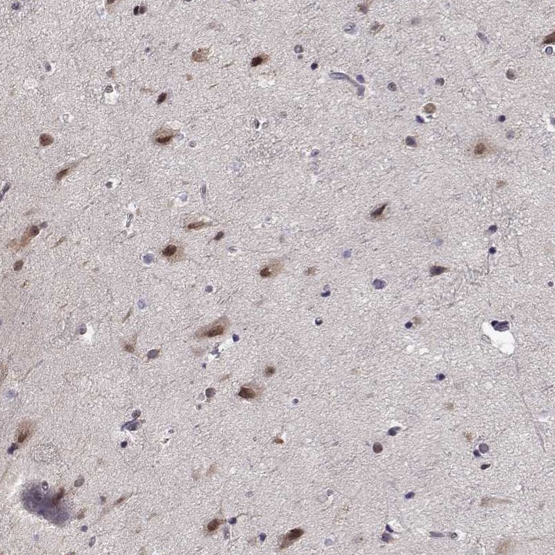 Atlas Antibodies Anti-TESPA1 Antibody
