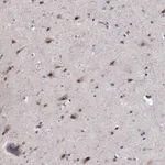 Atlas Antibodies Anti-TESPA1 Antibody