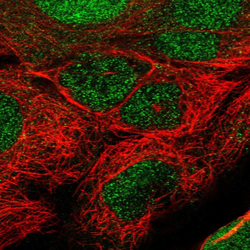Atlas Antibodies Anti-TET1 Antibody