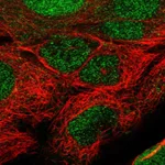 Atlas Antibodies Anti-TET1 Antibody