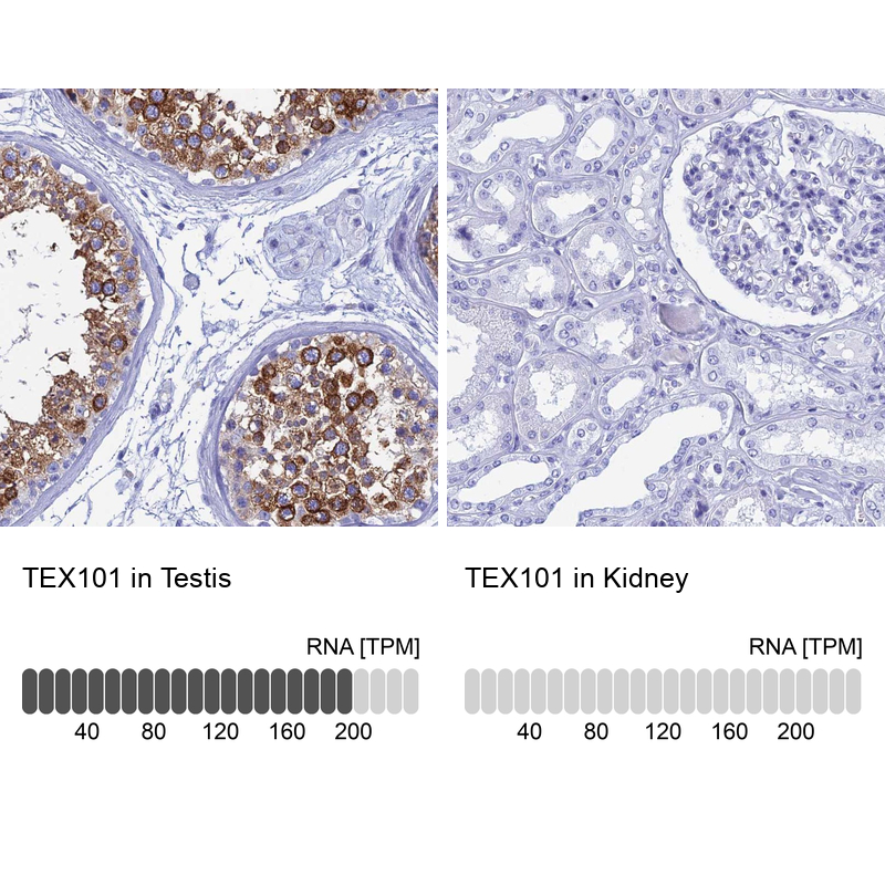 Atlas Antibodies Anti-TEX101 Antibody