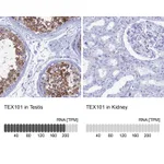 Atlas Antibodies Anti-TEX101 Antibody