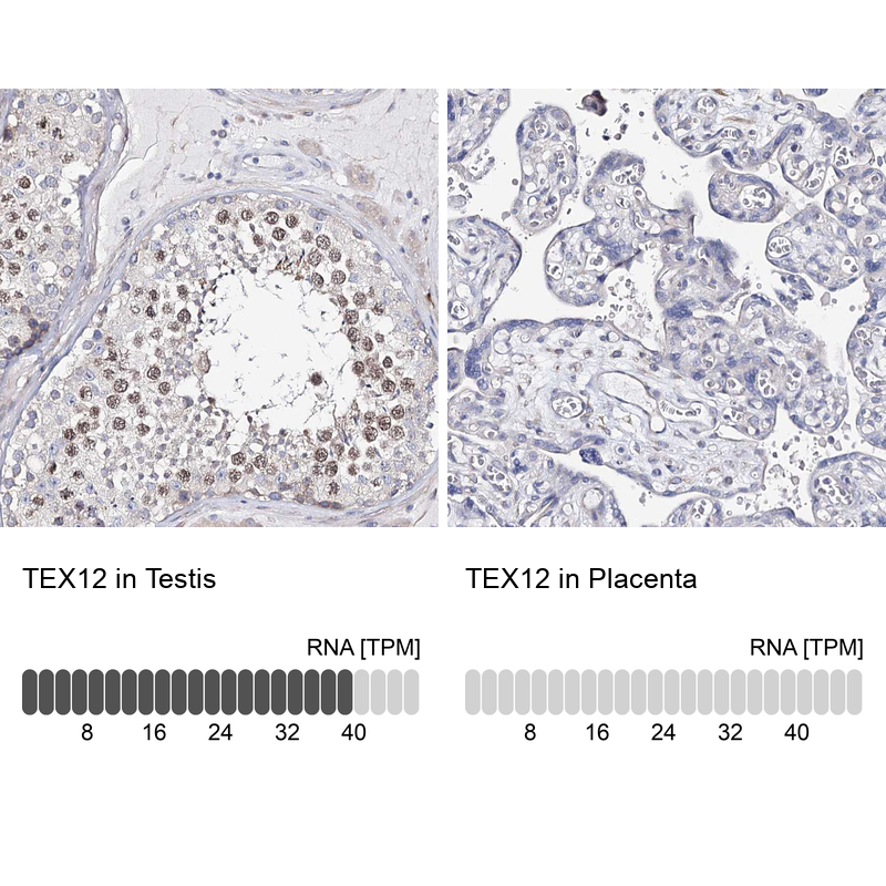 Atlas Antibodies Anti-TEX12 Antibody
