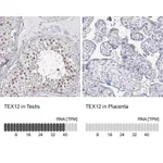 Atlas Antibodies Anti-TEX12 Antibody