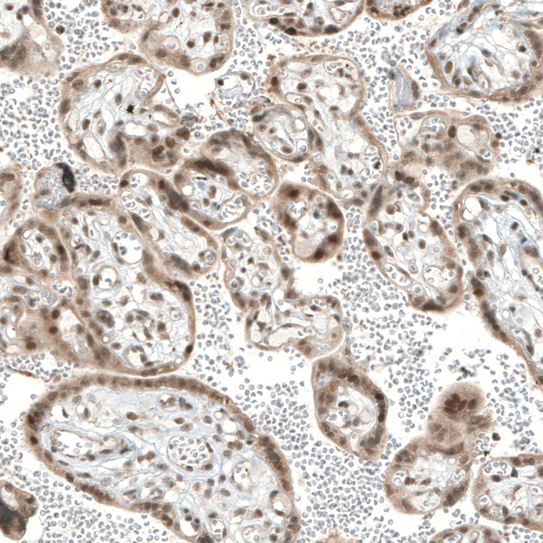 Atlas Antibodies Anti-TET1 Antibody