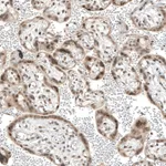 Atlas Antibodies Anti-TET1 Antibody