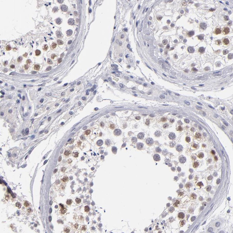 Atlas Antibodies Anti-TEX11 Antibody