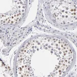 Atlas Antibodies Anti-TEX11 Antibody