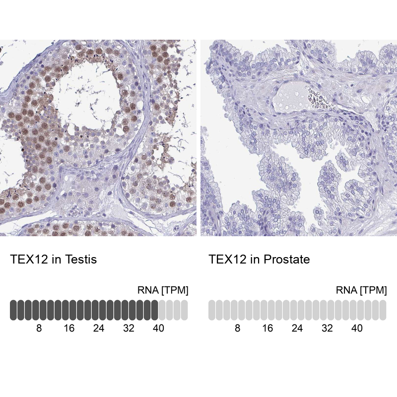 Atlas Antibodies Anti-TEX12 Antibody