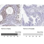 Atlas Antibodies Anti-TEX12 Antibody