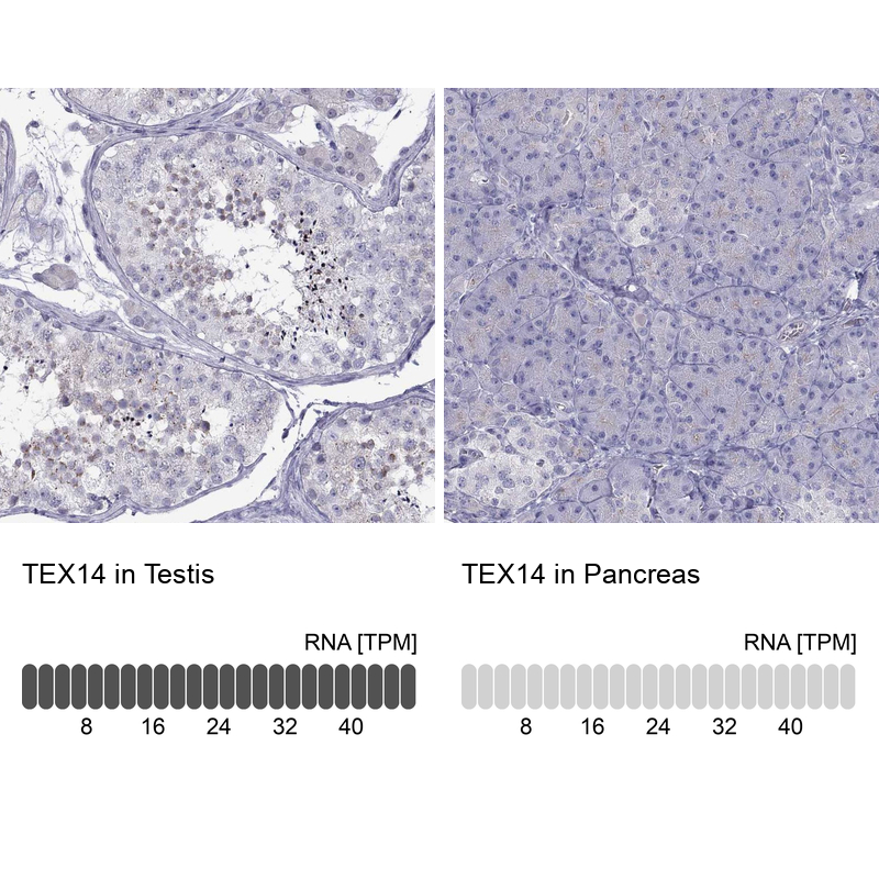 Atlas Antibodies Anti-TEX14 Antibody