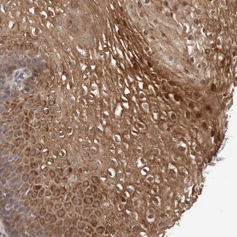 Atlas Antibodies Anti-TEX13B Antibody