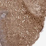 Atlas Antibodies Anti-TEX13B Antibody