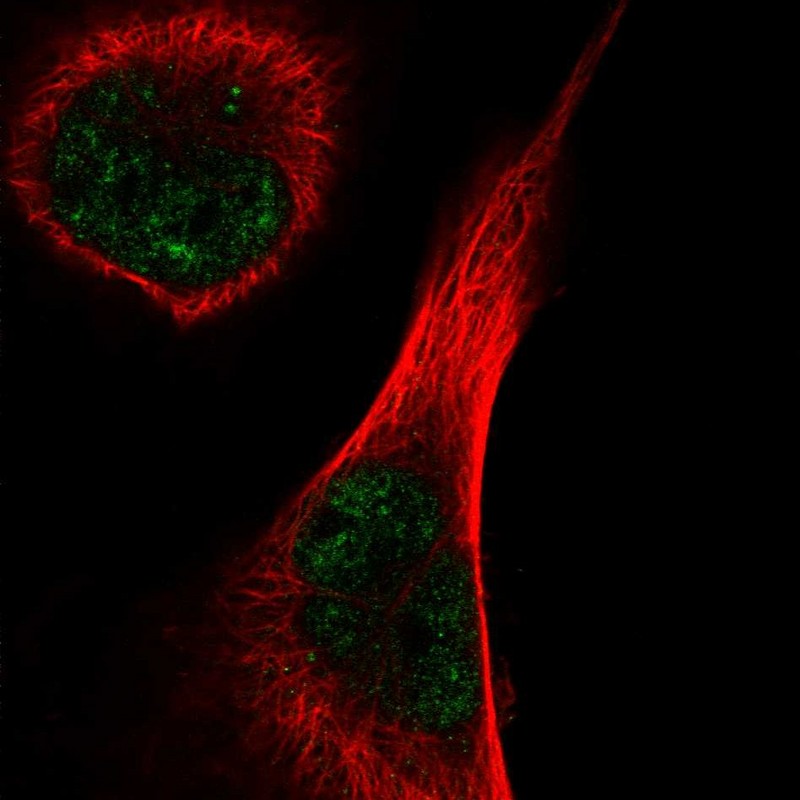 Atlas Antibodies Anti-TEX15 Antibody