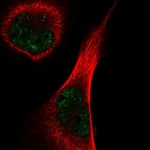 Atlas Antibodies Anti-TEX15 Antibody