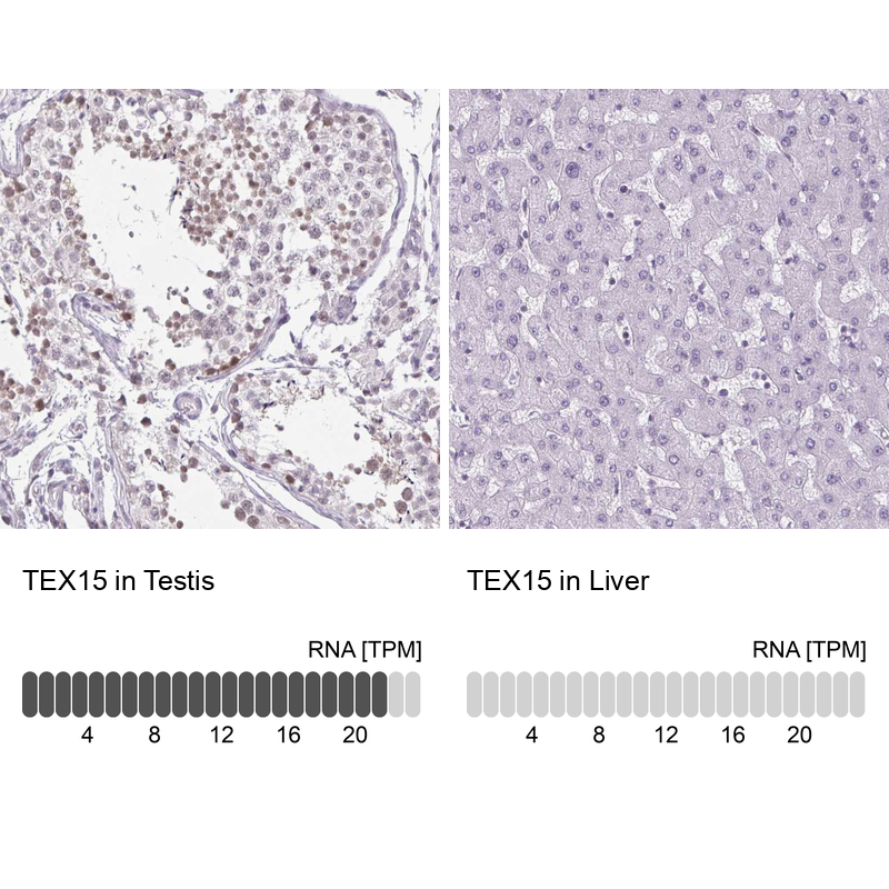 Atlas Antibodies Anti-TEX15 Antibody