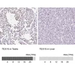 Atlas Antibodies Anti-TEX15 Antibody