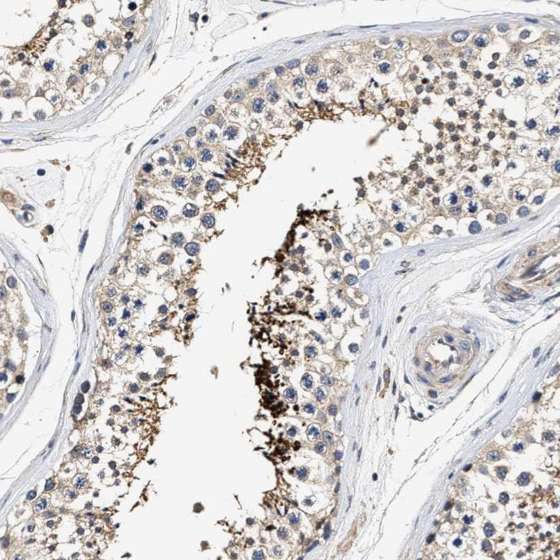 Atlas Antibodies Anti-TEX2 Antibody