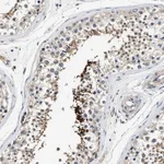Atlas Antibodies Anti-TEX2 Antibody