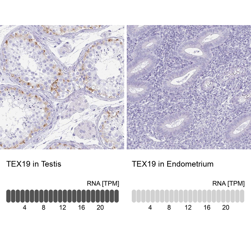 Atlas Antibodies Anti-TEX19 Antibody