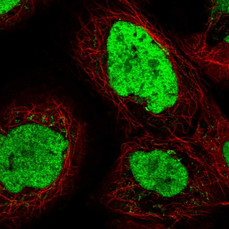 Atlas Antibodies Anti-TEX2 Antibody