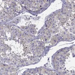 Atlas Antibodies Anti-TEX22 Antibody