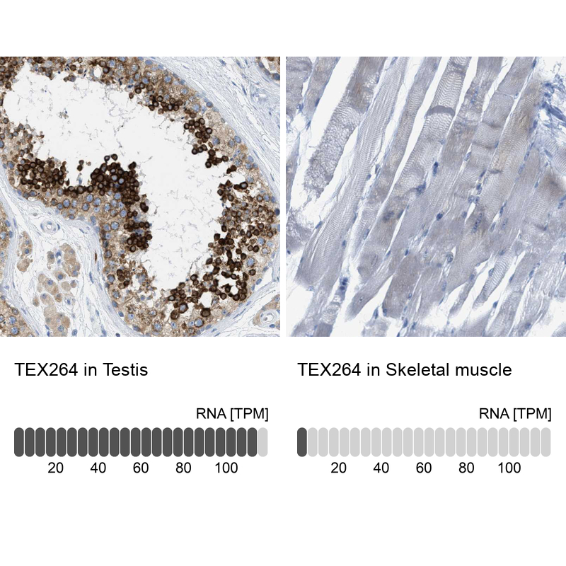 Atlas Antibodies Anti-TEX264 Antibody