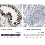 Atlas Antibodies Anti-TEX264 Antibody