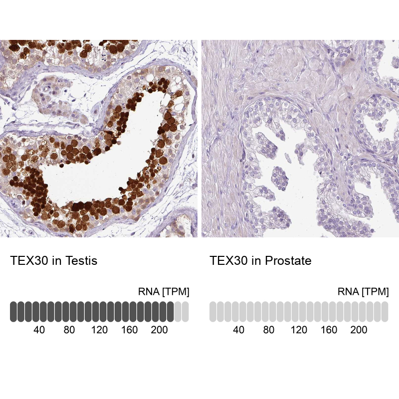 Atlas Antibodies Anti-TEX30 Antibody