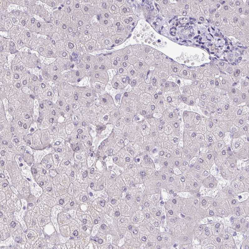Atlas Antibodies Anti-TEX33 Antibody