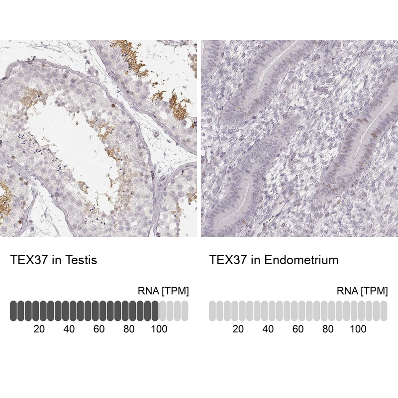 Atlas Antibodies Anti-TEX37 Antibody