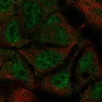 Atlas Antibodies Anti-TEX40 Antibody