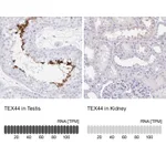 Atlas Antibodies Anti-TEX44 Antibody