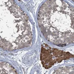 Atlas Antibodies Anti-TEX35 Antibody