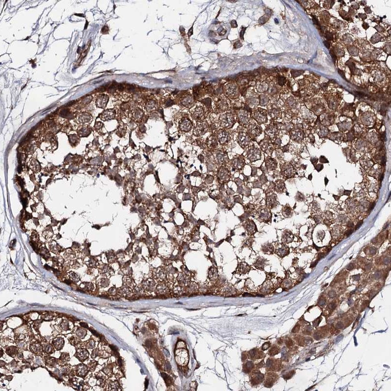 Atlas Antibodies Anti-TEX9 Antibody