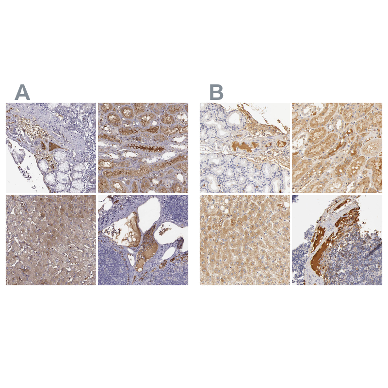 Atlas Antibodies Anti-TF Antibody