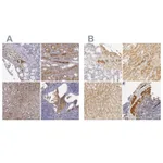 Atlas Antibodies Anti-TF Antibody
