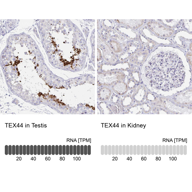 Atlas Antibodies Anti-TEX44 Antibody