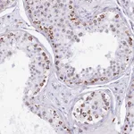 Atlas Antibodies Anti-TFAM Antibody